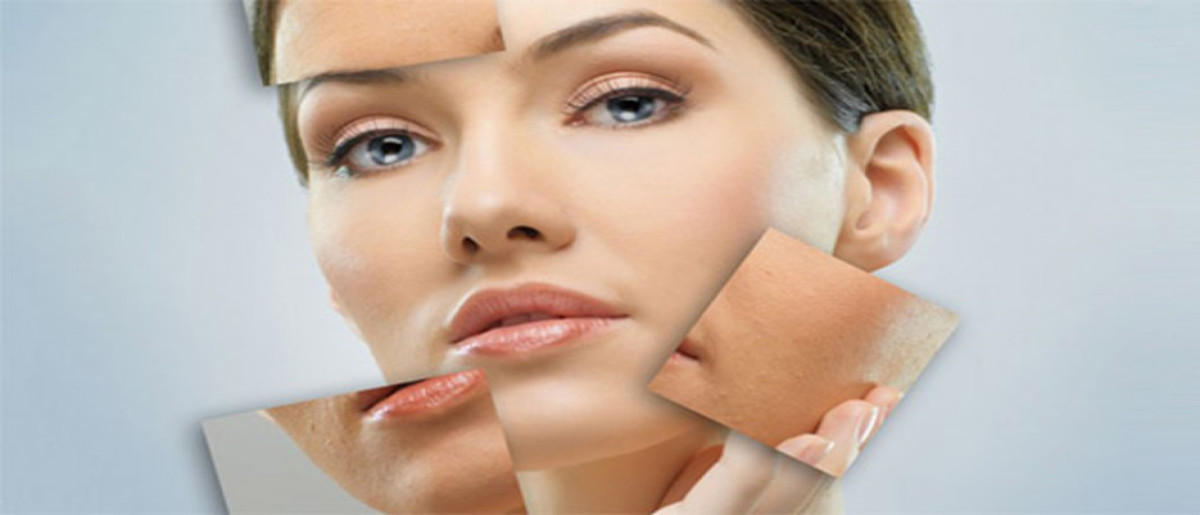 کربوکسی تراپی